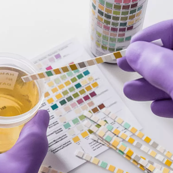 Does CBD Show Up on Drug Tests?